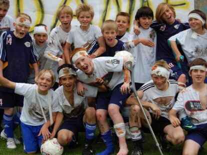 U 14 VfB Oldenburg - Zum Gl&uuml;ck nicht wirklich verletzt: Wer Fu&szlig;ball spielt, muss offene Br&uuml;che, blutende Wunden und andere kleine Blessuren in Kauf nehmen. Das zeigt die U-14 des VfB Oldenburg. BILD: VFB