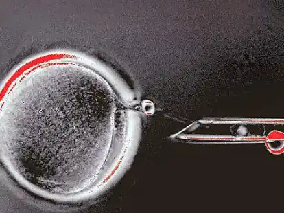 Die Wissenschaftler der Health & Science University Oregon stellten Bilder ihrem Experiment an einer Eizelle (links) ins Internet.