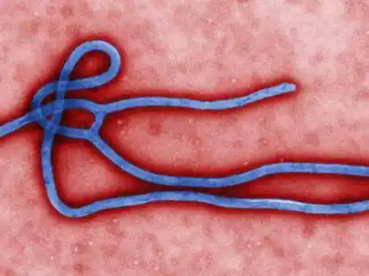 Das Ebola-Virus unterm Mikroskop.