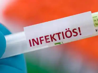 Die Delta-Mutation dominiert inzwischen auch in Deutschland das Infektionsgeschehen.