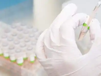 Ist der PCR-Test positiv, m&uuml;ssen Oldenburger diesen k&uuml;nftig in einem Online-Verfahren ans Gesundheitsamt melden und ihre Kontaktpersonen selbst &uuml;ber Infektion und Quarant&auml;ne informieren.