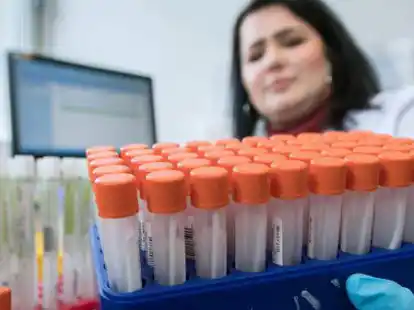 Gut zu tun haben zurzeit die Labore &ndash; zurzeit ist allerdings in Oldenburg nur einer von etwas sechs veranlassten PCR-Tests positiv, so das Gesundheitsamt.