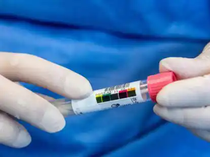 Immer mehr positive Coronatests gibt es im Ammerland.