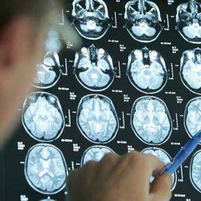 Ob ein Schlaganfall vorliegt, l&auml;sst sich mit bildgebenden Verfahren des Gehirns kl&auml;ren. Foto: Friso Gentsch/dpa