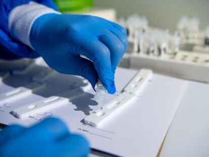 Im Landkreis Cloppenburg wurden am Donnerstag 623 neue Corona-F&auml;lle registriert.