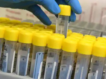 Im PCR-Labor bereitet eine medizinisch technische Laborassistentin die Bearbeitung von PCR-Tests in einem Automaten vor, die innerhalb von drei Stunden in dem Automaten analysiert werden. (Symbolbild)