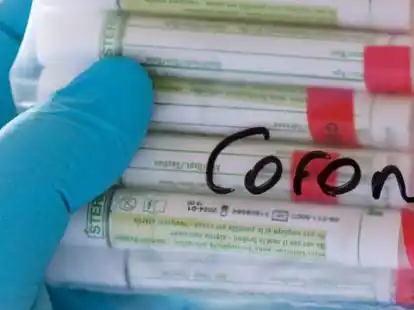 Proben f&uuml;r Corona-Tests werden f&uuml;r die weitere Untersuchung vorbereitet (Symbolbild): Im Ammerland sind die Zahlen der Infizierten so hoch wie noch nie.