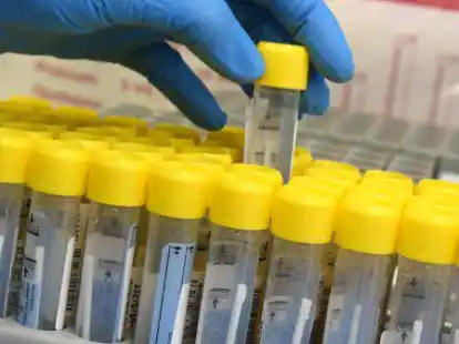 PCR-Labor: Da an den Wochenenden nur wenige Tests ausgewertet werden, sind montags die Zahlen der Neuinfektionen zumeist deutlich niedriger als Mitte oder Ende der Woche.