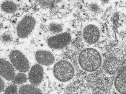 Affenpockenviren in mikroskopischer Ansicht