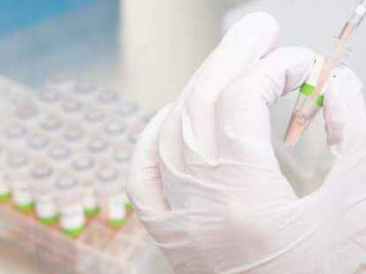 PCR-Test: Mittwochs sind die Corona-Zahlen zumeist am h&ouml;chsten. Dann liegen die Ergebnisse vor von Personen, die am Wochenende einen positiven Schnelltest oder Symptome hatten und am Montag beim Arzt den PCR-Test gemacht haben.