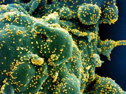 Dagegen hilft vor allem Impfen: Das Coronavirus (gelb) hat eine Zelle (gr&uuml;n) befallen. Die Aufnahme stammt vom US-Forschungszentrum &bdquo;National Institute of Allergy and Infectious Diseases&ldquo;.