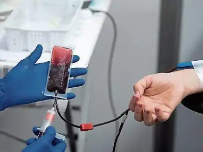Jetzt zur Urlaubssaison wird weniger Blut gespendet. Wir haben bei den Kliniken in Ostfriesland nachgefragt, wie sich die Situation auf die Versorgung schwerkranker Menschen und auf Operationen auswirkt.