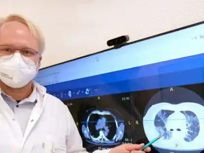 Chefarzt Dr. Jens Br&auml;unlich bietet gemeinsam mit seinem Kollegen, Chefarzt Dr. Peter Krieg, die neue Sprechstunde an.