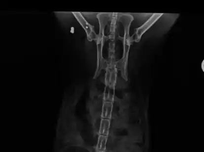 Die im Gewebe eingekapselten Geschosse kamen zuf&auml;llig beim R&ouml;ntgen ans Licht.