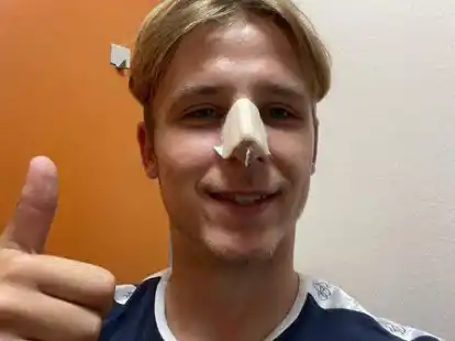 Hat die Nase nach einem Bruch gerichtet bekommen: BWB-Stammspieler Brian Wienekamp.