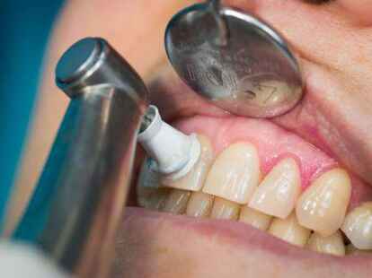 Welchen Farbton unsere Z&auml;hne genau haben, wird auch durch unsere Genetik bestimmt.