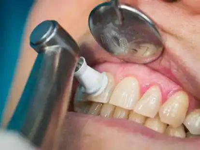 Welchen Farbton unsere Z&auml;hne genau haben, wird auch durch unsere Genetik bestimmt.