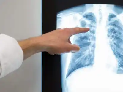 Ganz deutlich: Nicht jedes Krankenhaus kann die moderne Diagnostik und Therapieform vorhalten. Auch deshalb wollen  die Krankenh&auml;user in Wilhelmshaven und Friesland kooperieren.