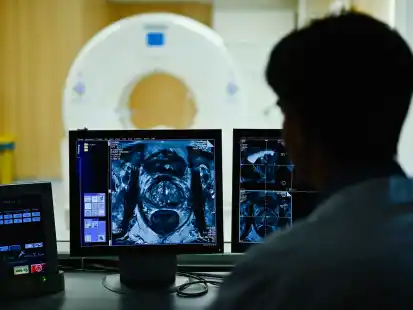 Ein Mitarbeiter betrachtet in einem Kontrollraum des Deutschen Krebsforschungszentrum (DKFZ) das Querschnittsbild einer Prostata.