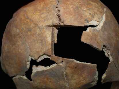 Diese Nahaufnahme zeigt den Sch&auml;del mit der Trepanation.