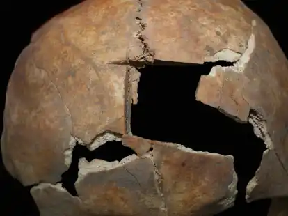 Diese Nahaufnahme zeigt den Sch&auml;del mit der Trepanation.