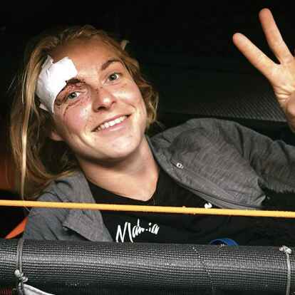 Sie kann noch l&auml;cheln: Co-Skipperin Rosalin Kuiper wurde aus der Koje geschleudert, schlug sich den Kopf an und zog sich eine Platzwunde und eine Gehirnersch&uuml;tterung zu.