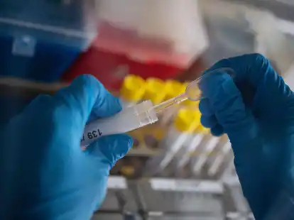 Erneut wurde ein H3N8-Fall bei einem Menschen gemeldet. Die WHO sch&auml;tzt das Risiko, dass sich das Virus unter Menschen ausbreitet, bisher jedoch gering ein.