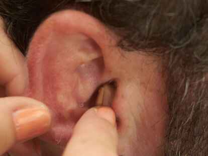 H&ouml;rger&auml;te k&ouml;nnen bei vielen &auml;lteren Menschen eine Demenz vermeiden.