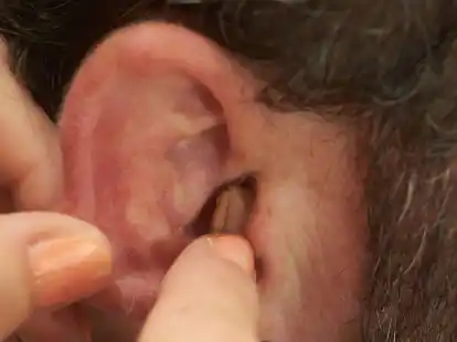 H&ouml;rger&auml;te k&ouml;nnen bei vielen &auml;lteren Menschen eine Demenz vermeiden.