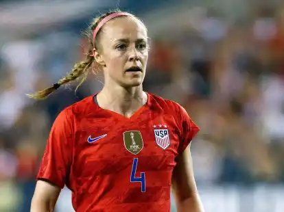 Die US-Amerikanerin Becky Sauerbrunn droht mit einer Fu&szlig;-Verletzung die WM zu verpassen.