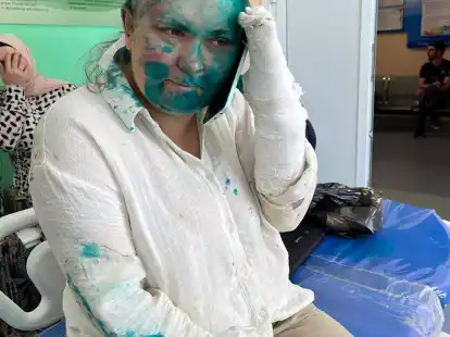Investigativreporterin Jelena Milaschina wurde nach der Attacke in einem Krankenhaus behandelt.