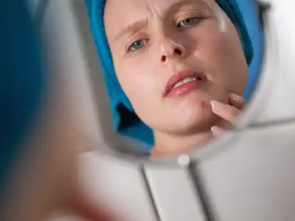 Mist, ein Pickel! Einfach unter Blasenpflastern ausheilen lassen, lautet ein Trick, der in den sozialen Netzwerken unterwegs ist.