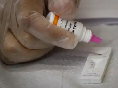 In wenigen Minuten gibt es Gewissheit, ob man sich mit dem HI-Virus infiziert hat.