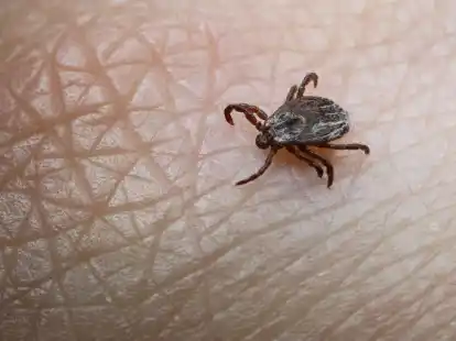 Unerw&uuml;nschte Begegnung: Wer viel drau&szlig;en unterwegs ist, kann den Kontakt mit Zecken nicht immer vermeiden. Schutz bieten etwa lange Hosenbeine.