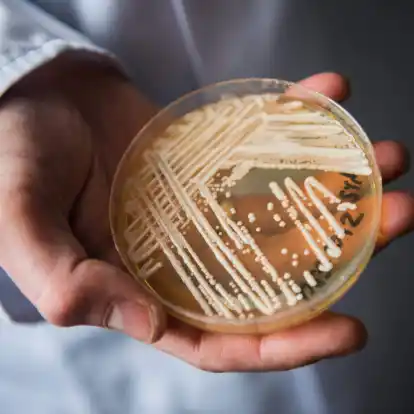 Eine Petrischale mit dem Hefepilz Candida auris. In Deutschland werden immer mehr Fälle des krankmachenden Pilzes bekannt.