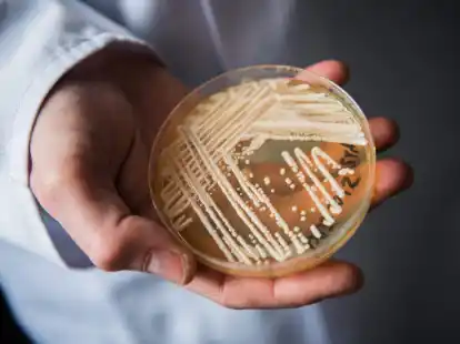 Eine Petrischale mit dem Hefepilz Candida auris. In Deutschland werden immer mehr Fälle des krankmachenden Pilzes bekannt.