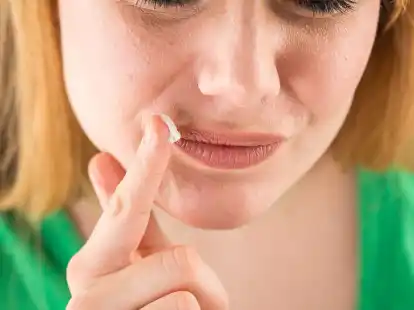 Gegen die trockene Haut und damit gegen Rhagaden: Gerade im Winter ist eine gute Haut- und Lippenpflege wichtig. (zu dpa: &laquo;Autsch! Was hilft bei eingerissenen Mundwinkeln?&raquo;)