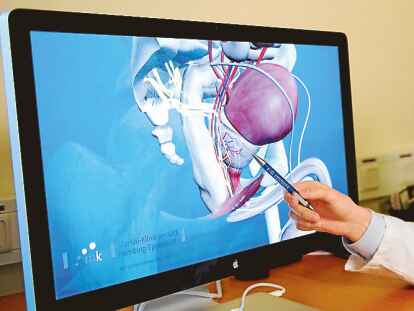 Symbolfoto: Mit einem Stift zeigt dieser Arzt auf ein 3D-Modell einer Prostata.