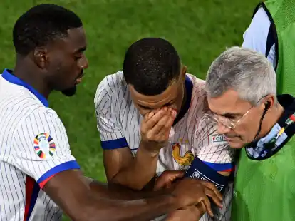 Mbapp&eacute; (M) musste mit stark blutender Nase ausgewechselt werden.