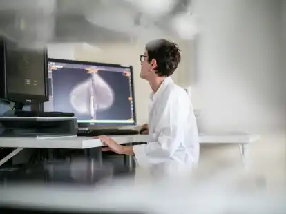 Fortschritte in der Krebsmedizin: Mammografie senkt Sterberate bei Brustkrebs deutlich